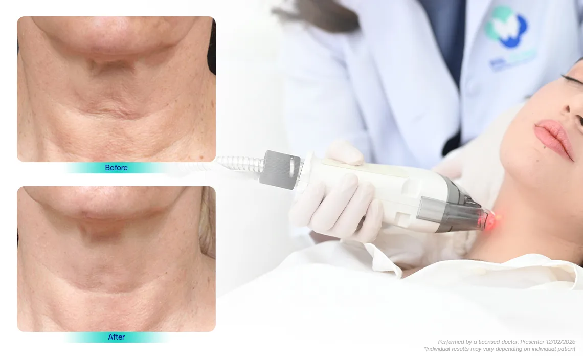 Neck-lines-wrinkles-or-pores-are-found-among-the-older