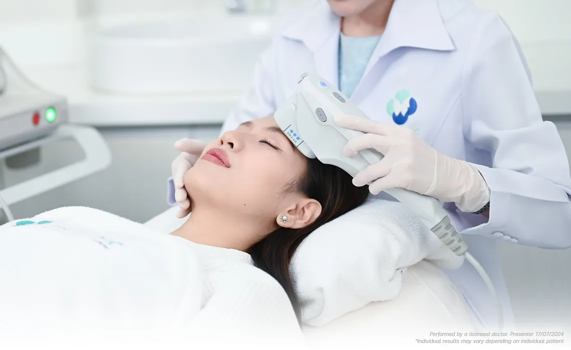 2-Ultherapy-Brows-Eyelids-Lifting