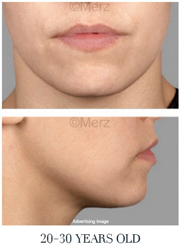 early signs of aging face lift comparison young skin jawline tightness before treatment