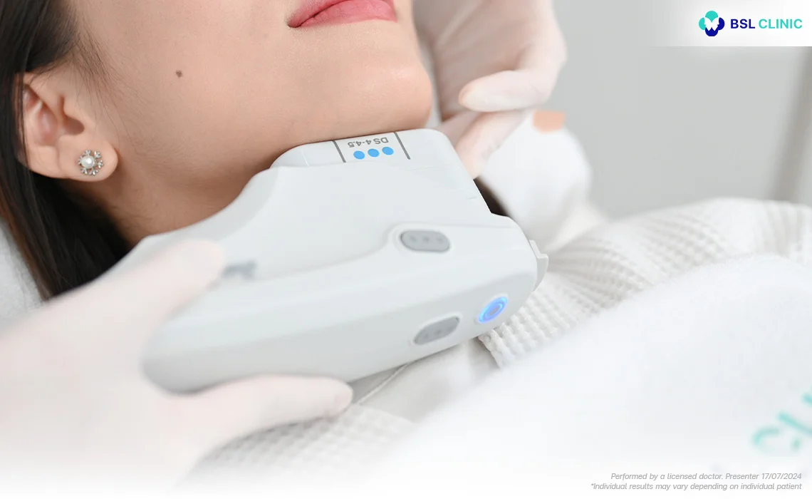 Ulthera-Super-Plus-Face-Lifting