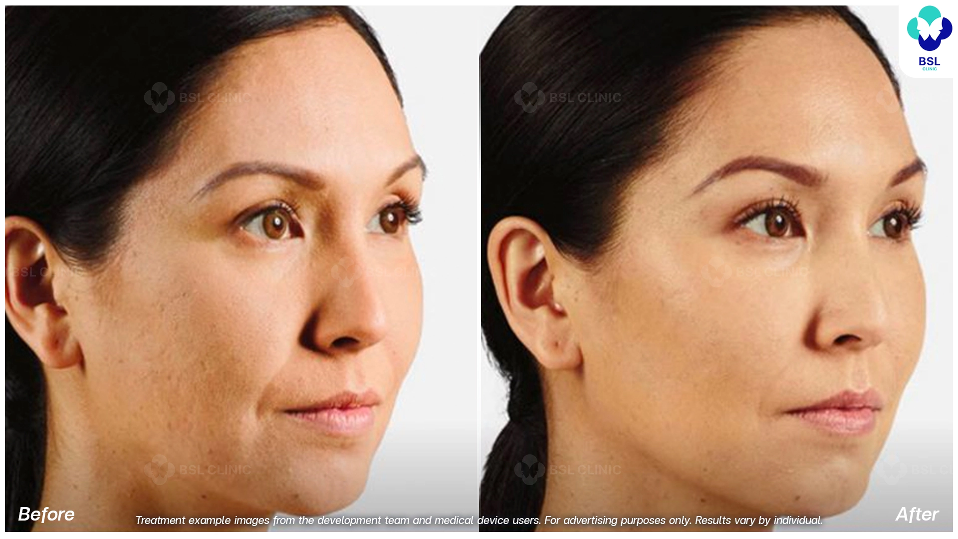 Natural Changes You Can See