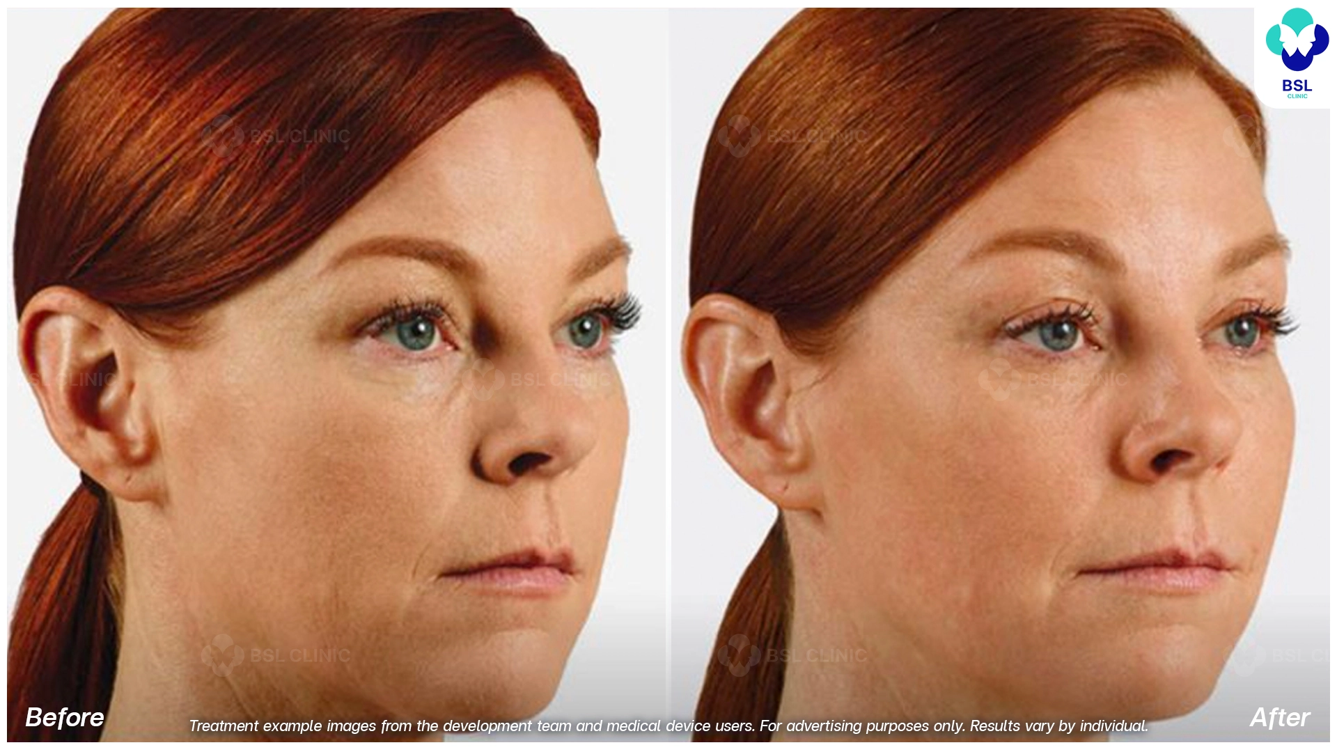 Natural Changes You Can See