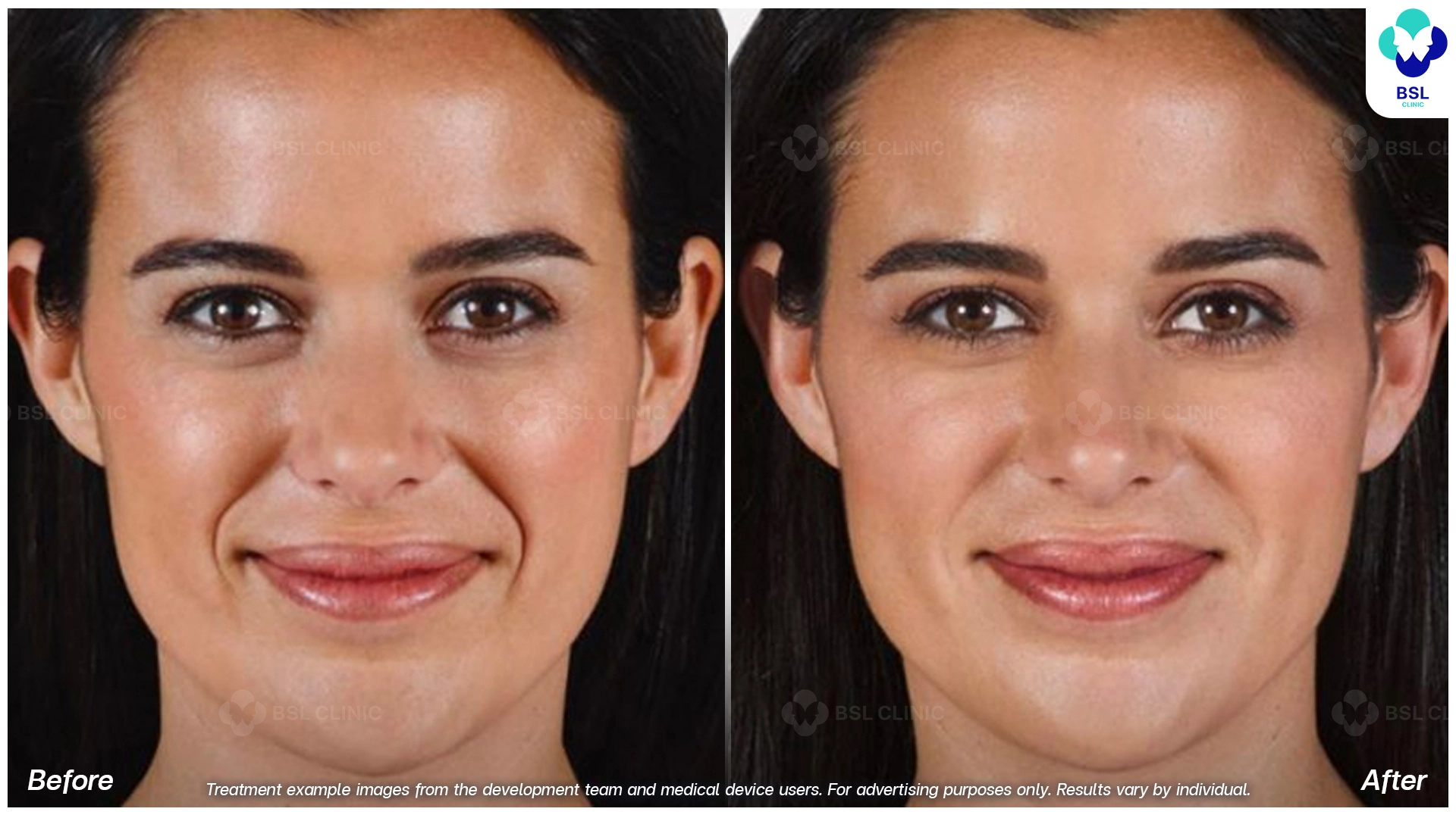 Natural Changes You Can See