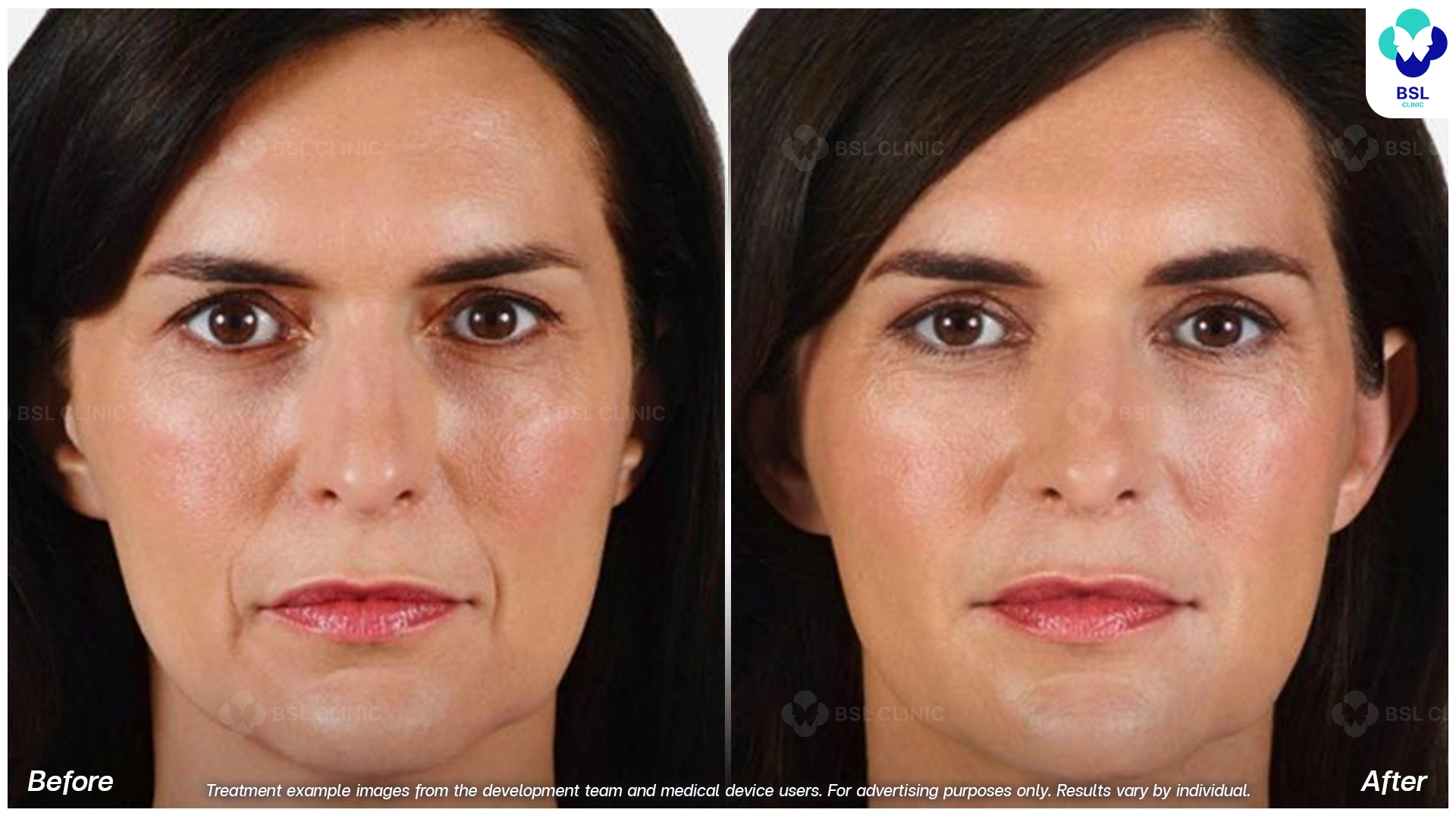 Natural Changes You Can See