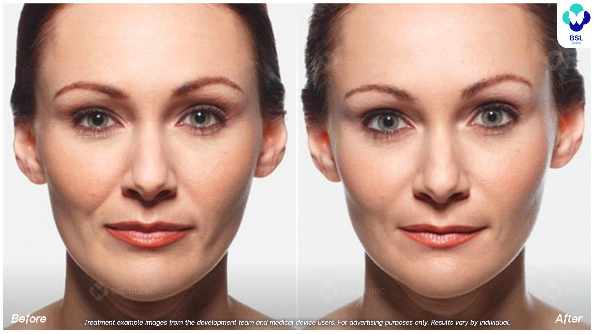 Natural Changes You Can See
