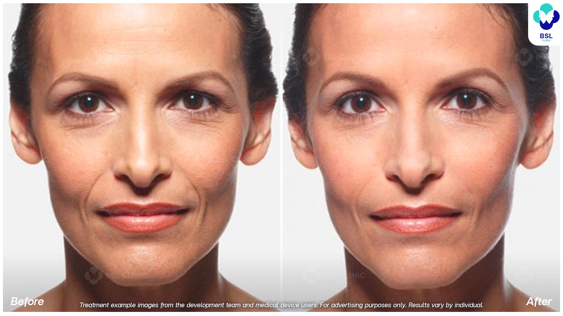 Natural Changes You Can See
