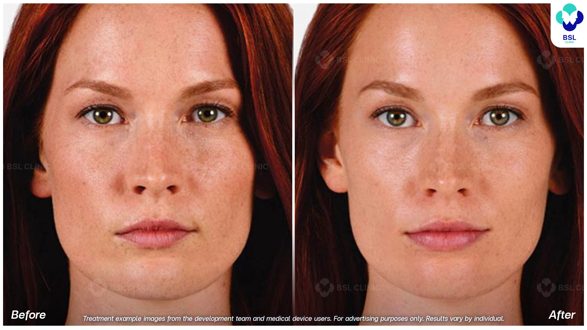 Natural Changes You Can See