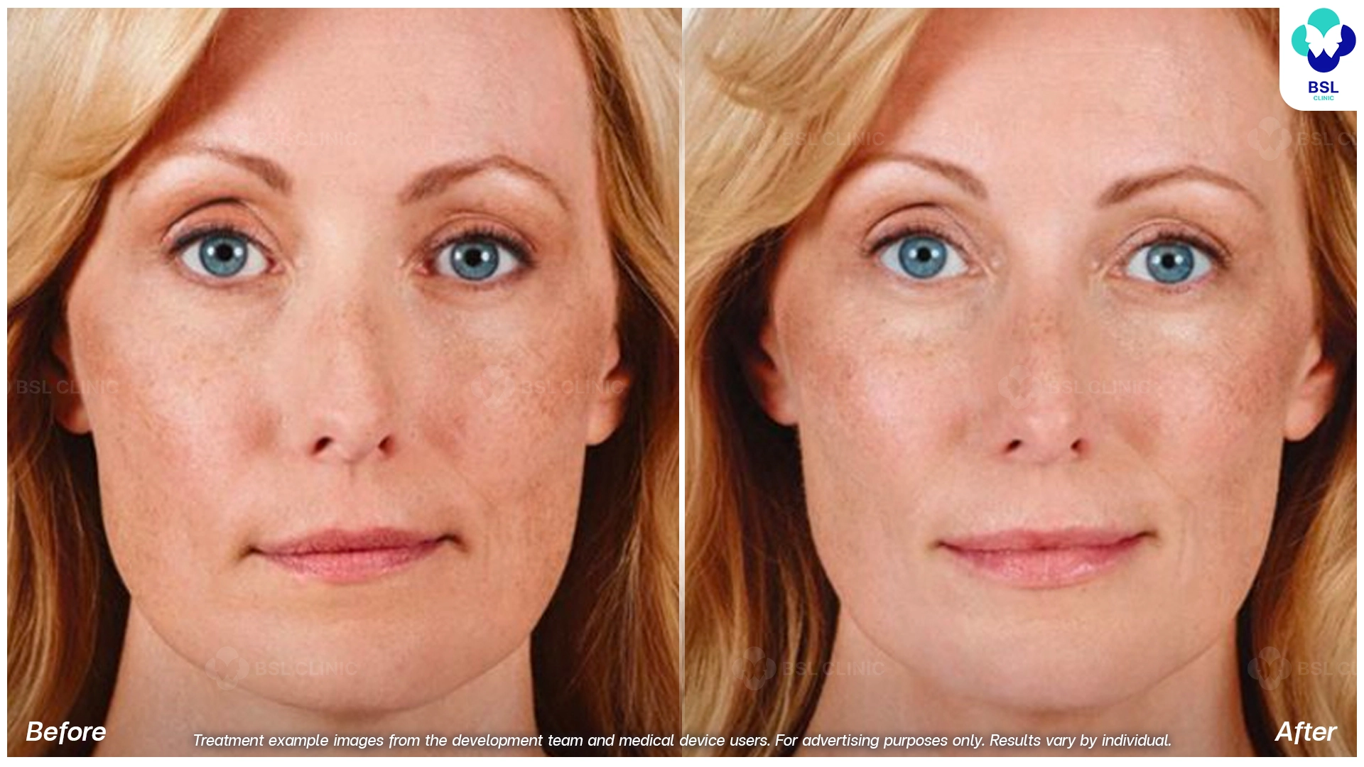 Natural Changes You Can See