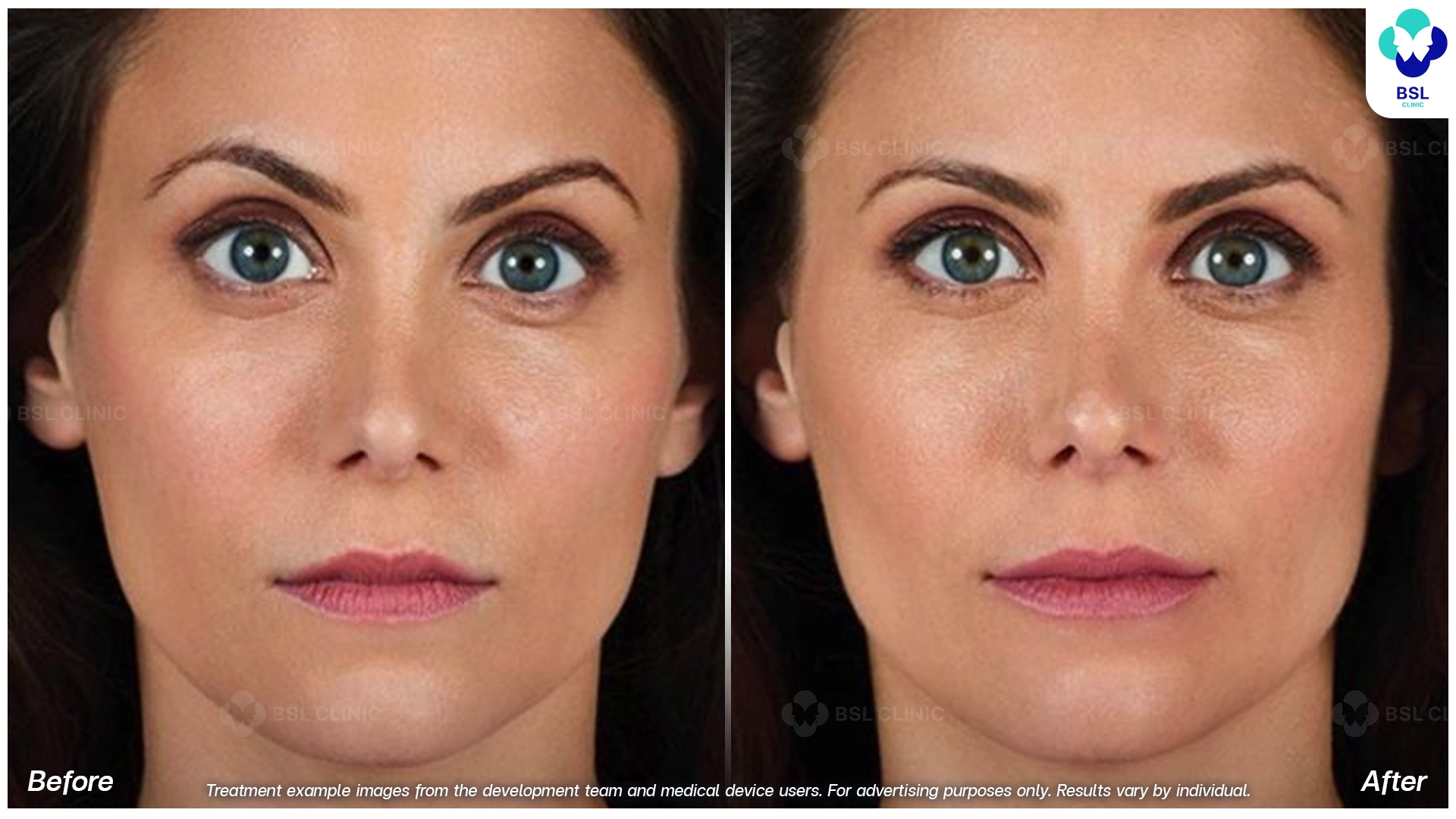 Natural Changes You Can See