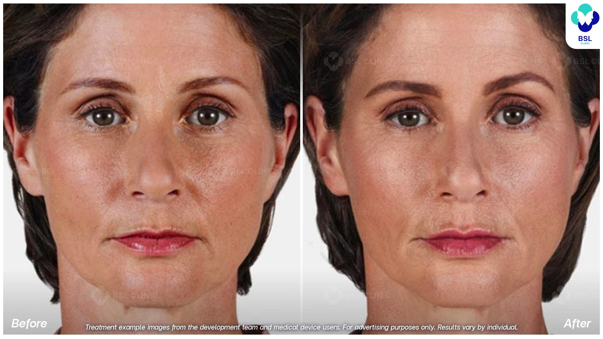 Natural Changes You Can See