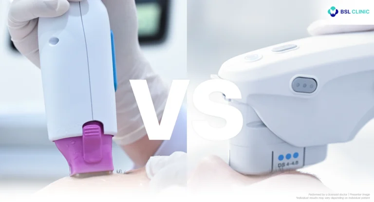 Thermage vs Ultherapy Programs
