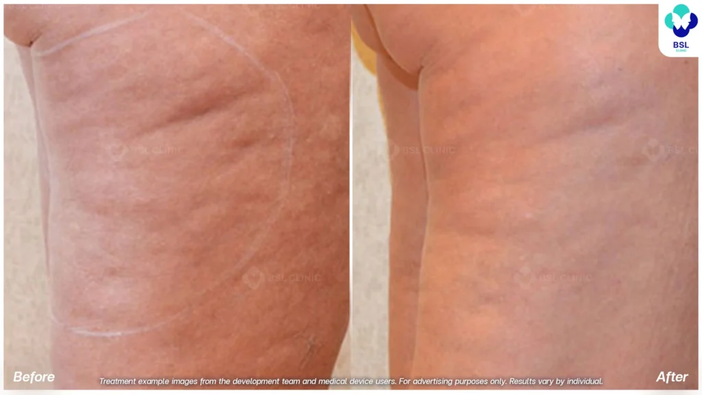 Result BodyFX Program