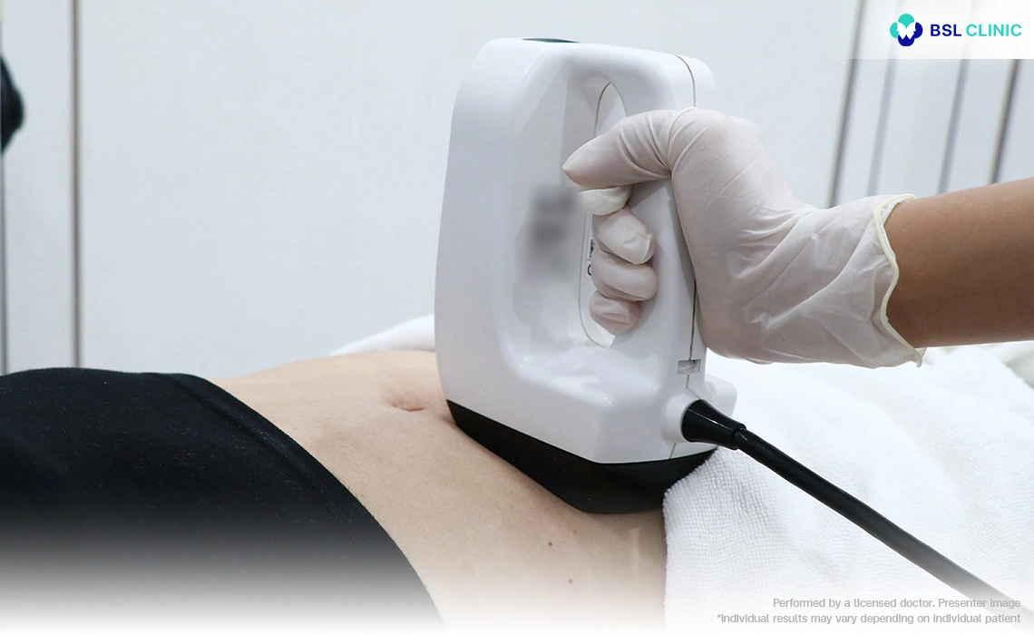 Body contouring BodyFX Program
