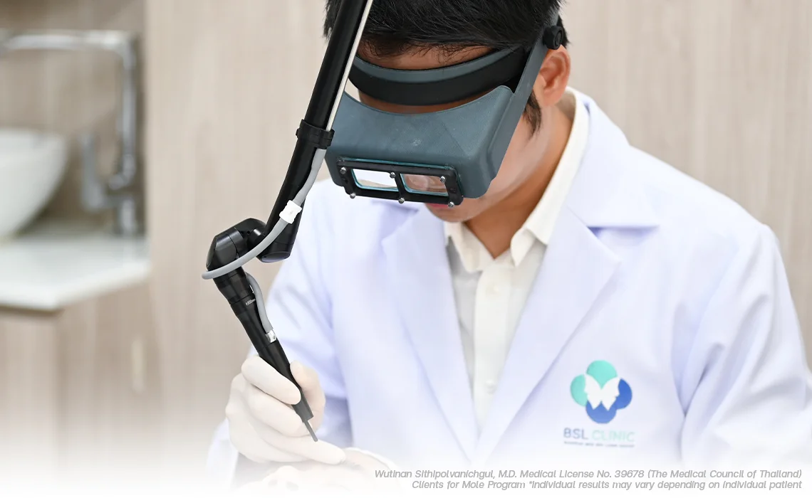 CO2-laser