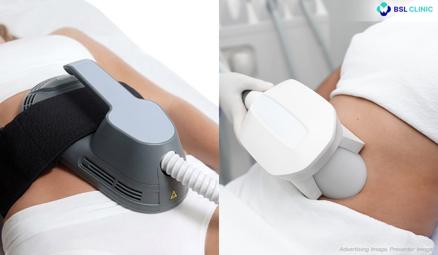 Comparison of EMSculpt Neo with other body contouring treatments at BSL Clinic Bangkok