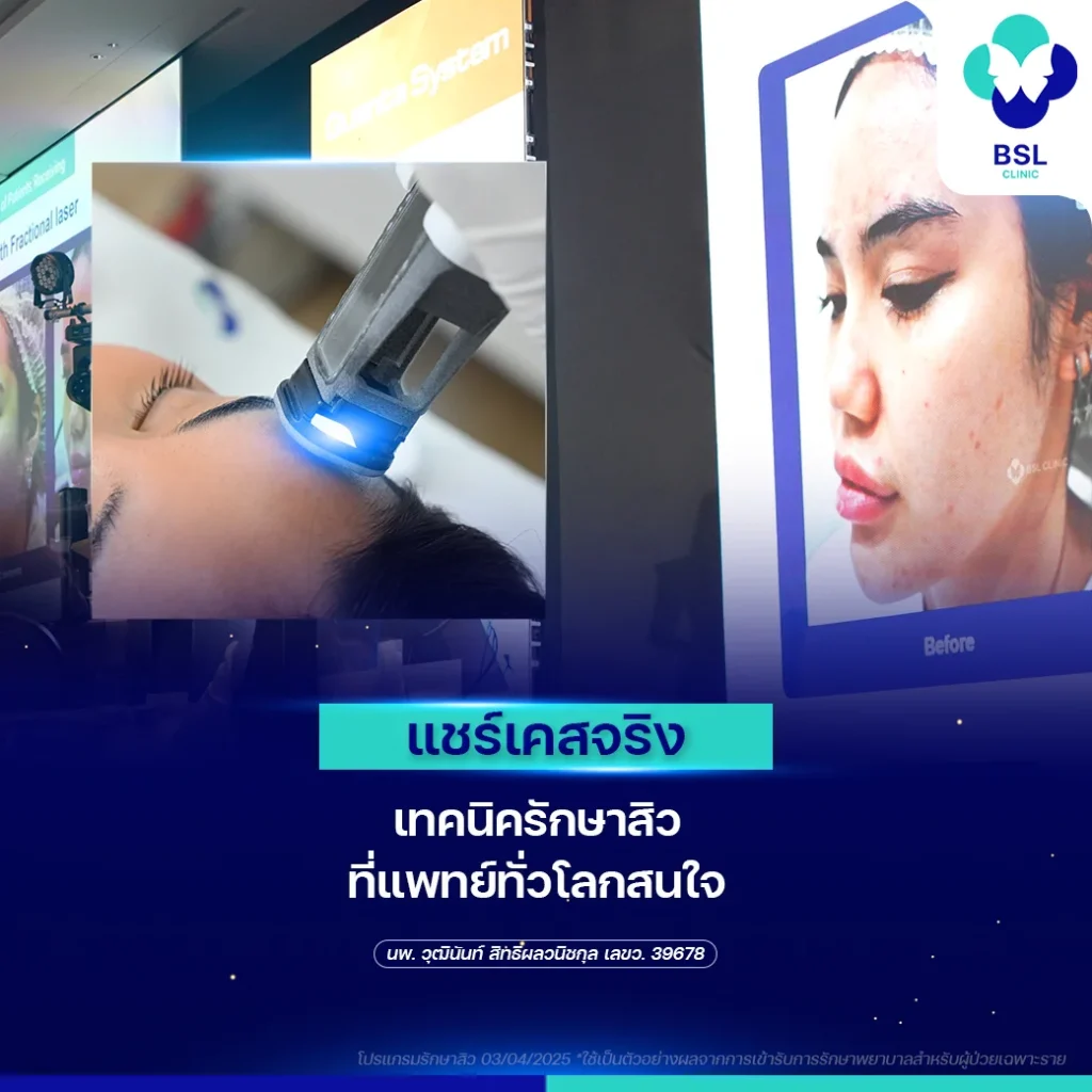 Quanta-symposium-bsl-clinic