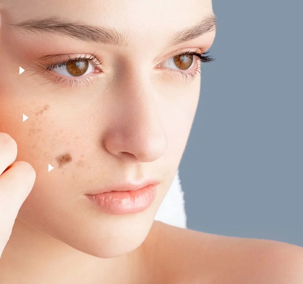 fraxel dual resurfacing laser treatment for acne scars pigmentation and fine lines fraxel laser technology dual fraxel laser wavelength used in fraxel laser bangkok aesthetic laser treatment