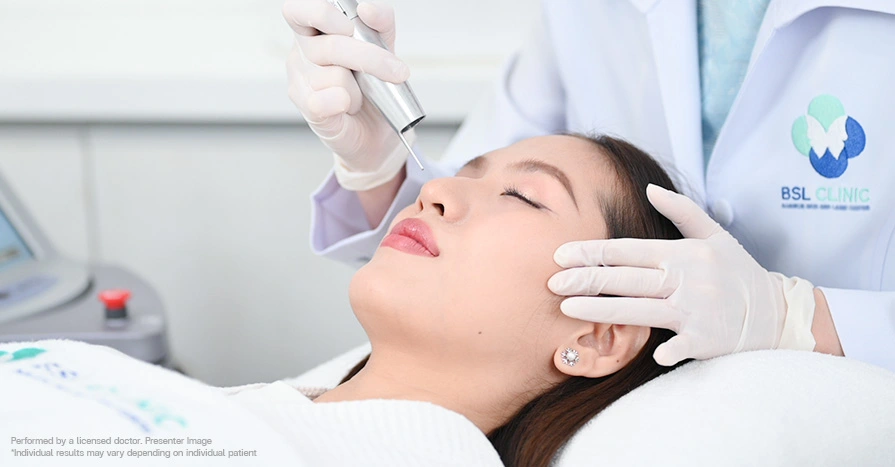 Frackles Revlite Laser program