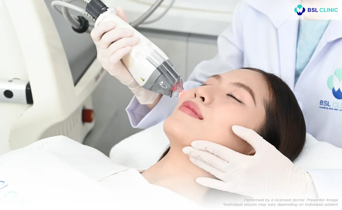 Fraxel Dual Laser treatment