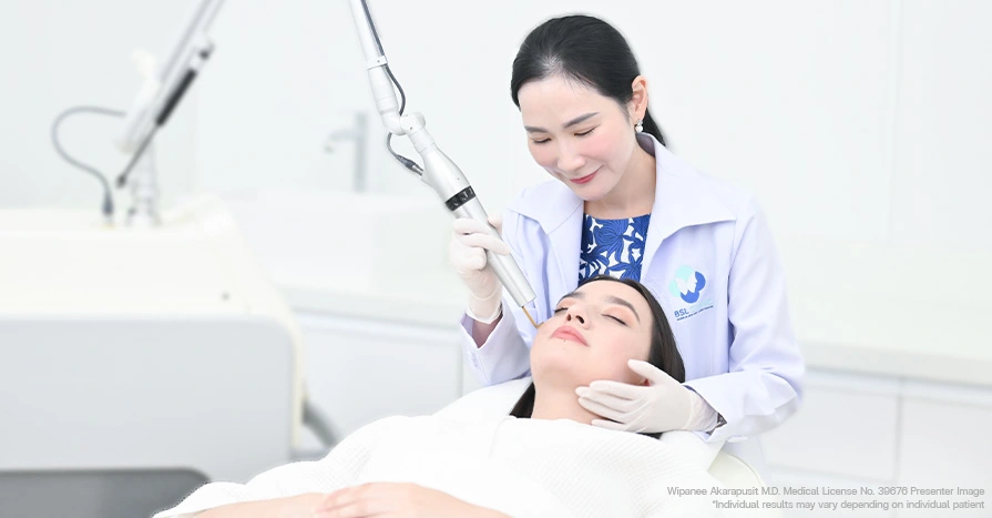 Freckles Picoway laser