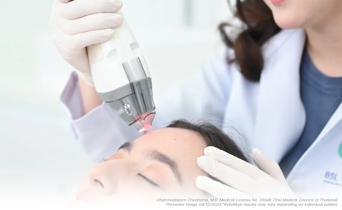 How it works Photofractional Rejuvenation Laser
