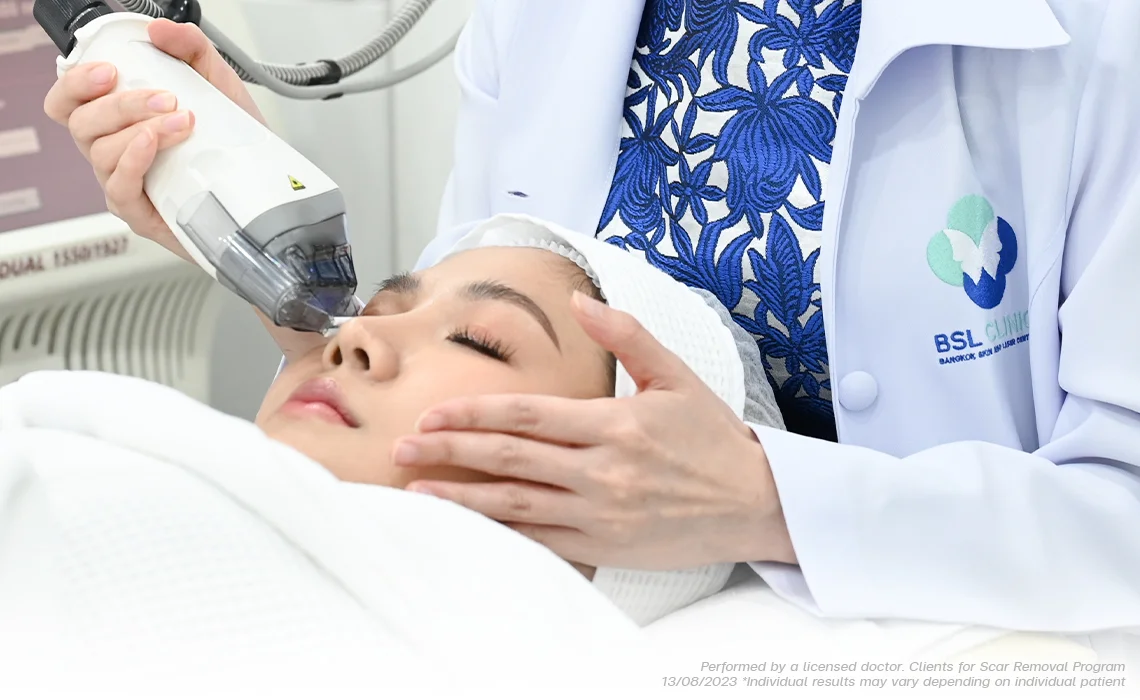 How it works Scar Removal Laser