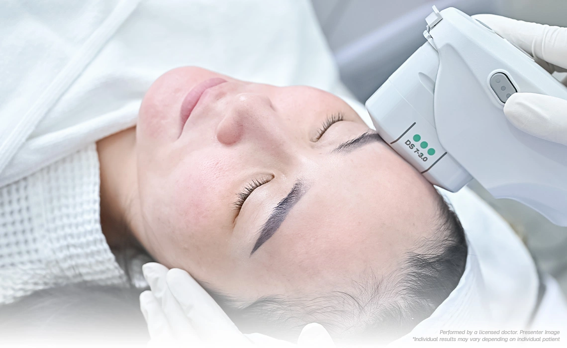 non surgical face lift ultherapy program for sagging skin jawline lift in 40s without downtime