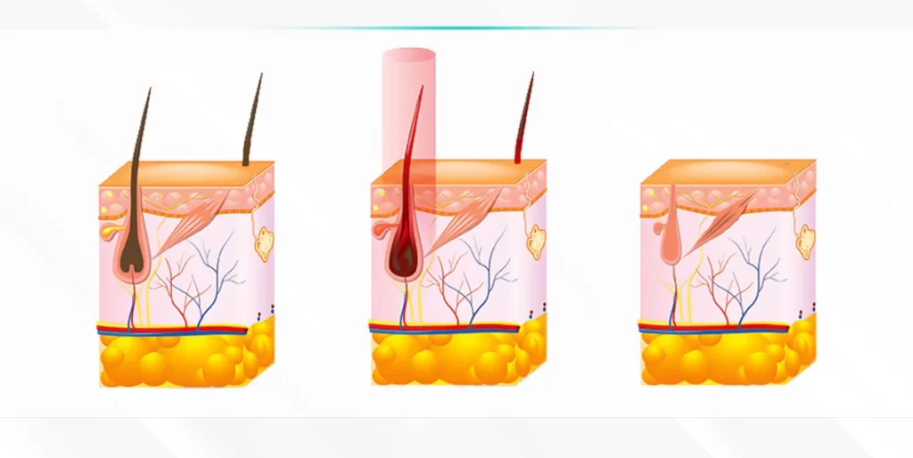 Lightwave Laser Technologies