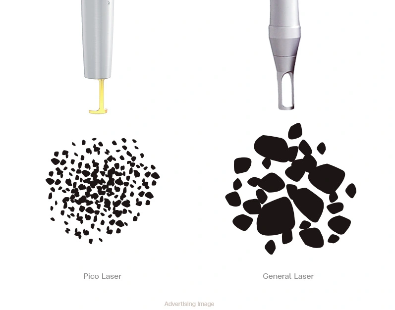 Pico laser vs general laser