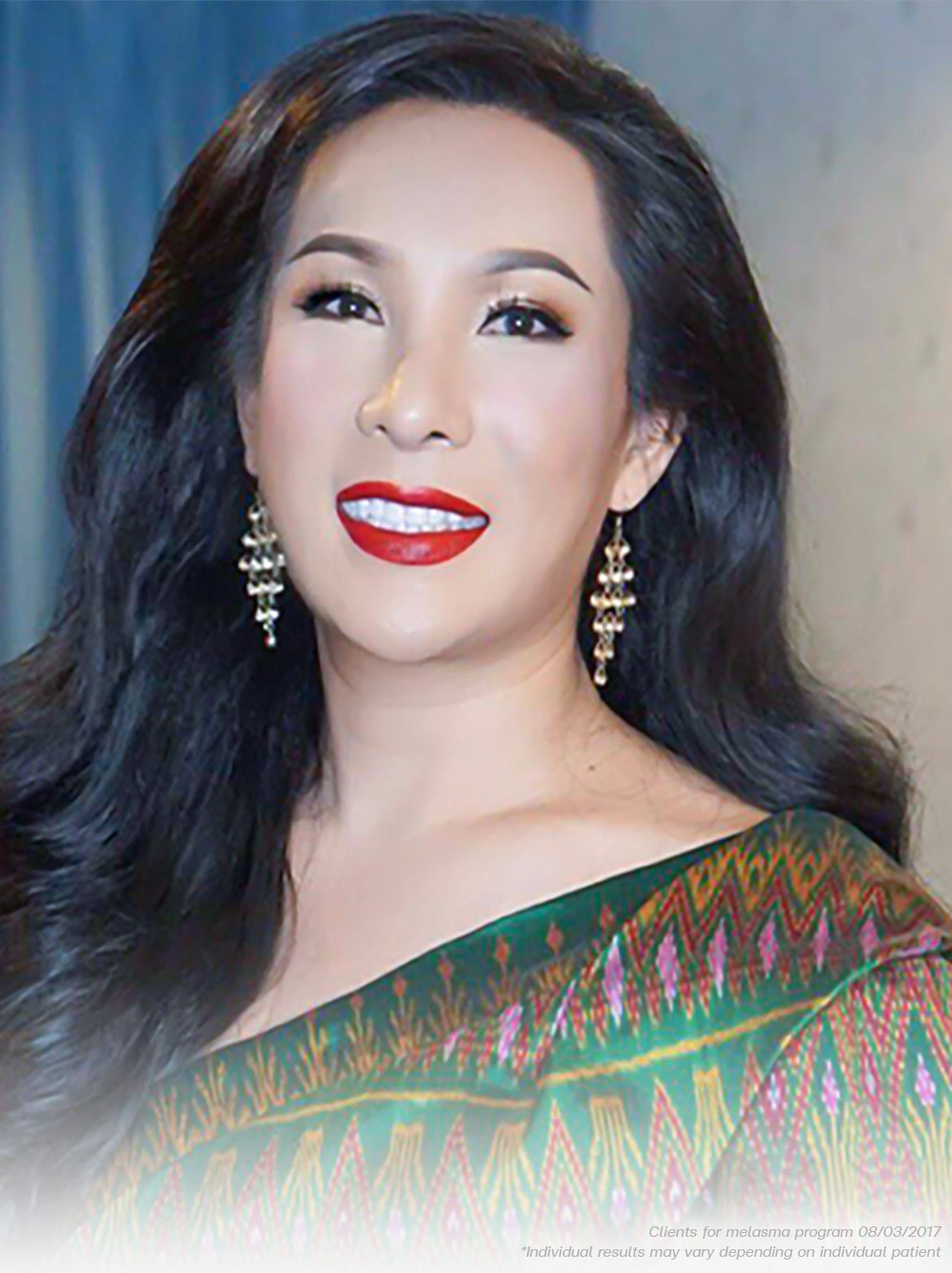 Melasma is Treatable at BSL Clinic