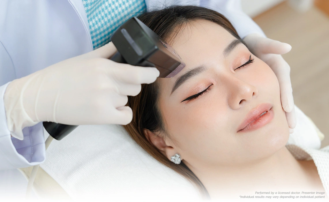 morpheus8 face lift skin refinement and pore tightening for 20s