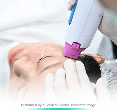 thermage flx face lift skin tightening treatment non surgical firm and smooth program