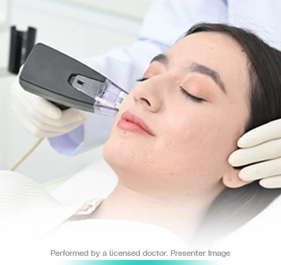 morpheus8 microneedling rf face lift sculpt and refine skin rejuvenation non invasive contour