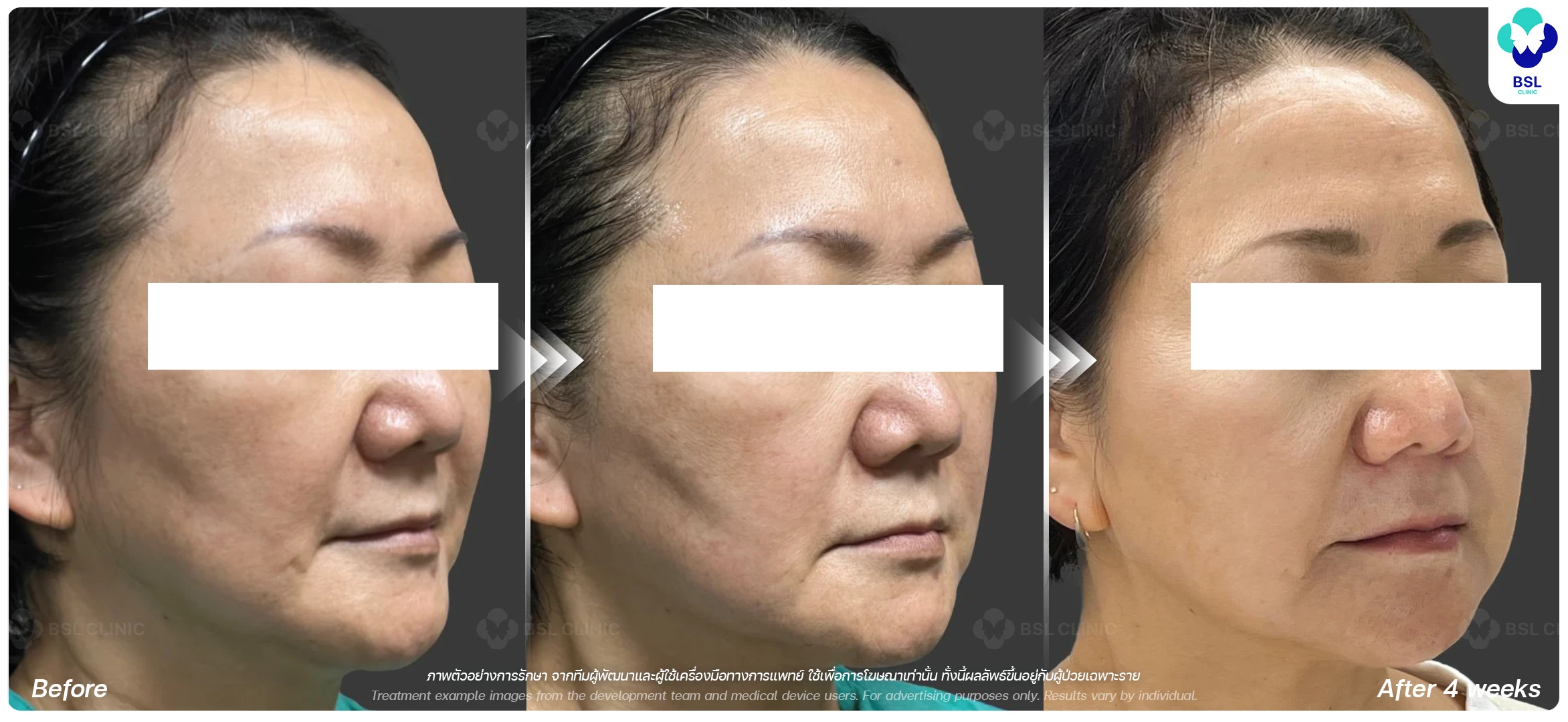 รีวิวผลลัพธ์การทำ OligioX Program