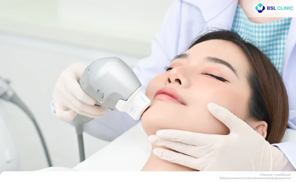 OligioX + Ultraformer III Program ผิวเรียบเนียนขึ้น ลดไขมันสะสม ปรับรูปหน้าให้เรียววีเชฟ