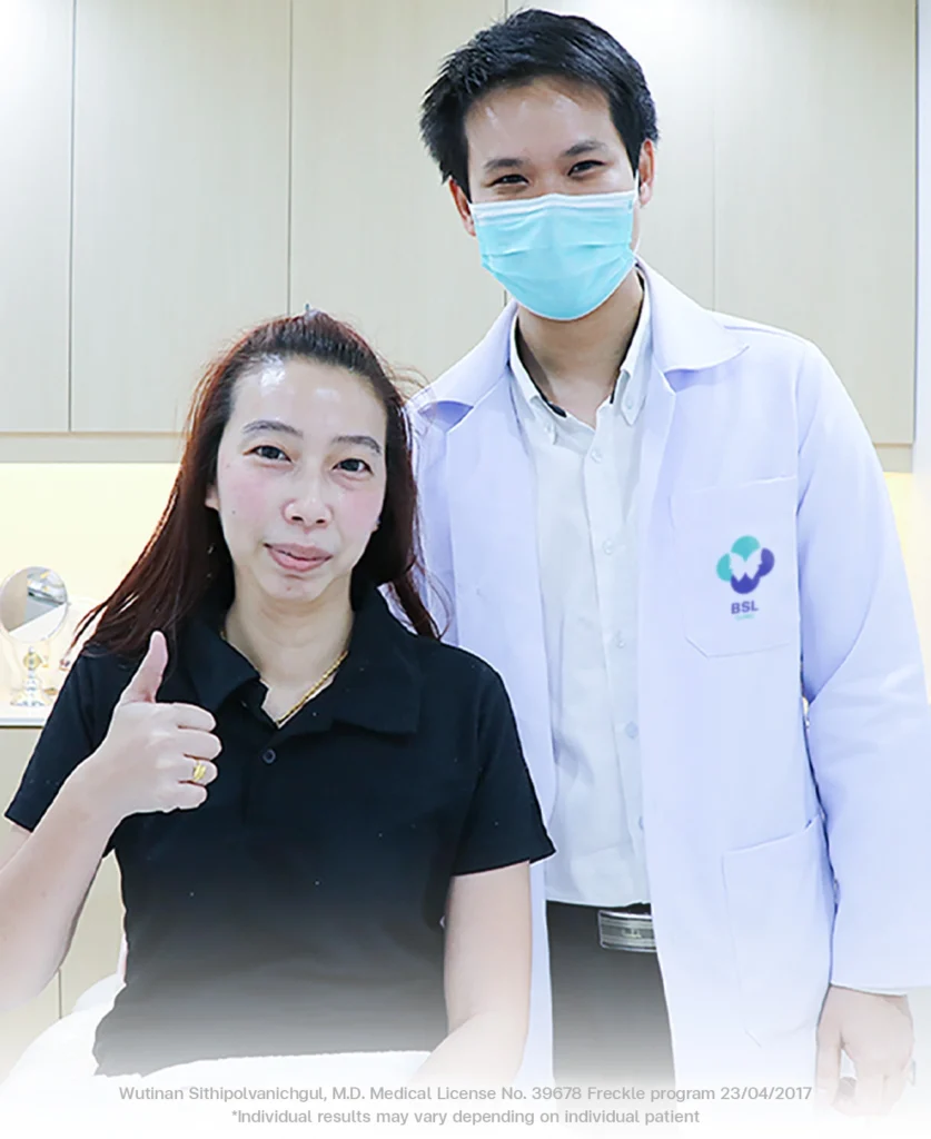 Patient Treatment at BSL Clinic Frackles dark spot