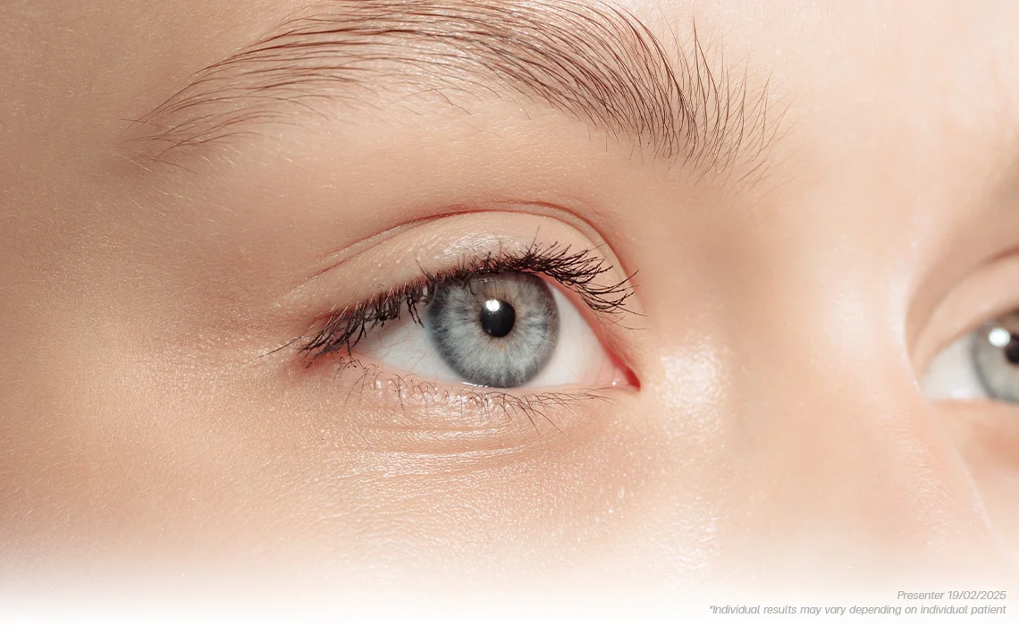 Periorbital Wrinkle Reduction