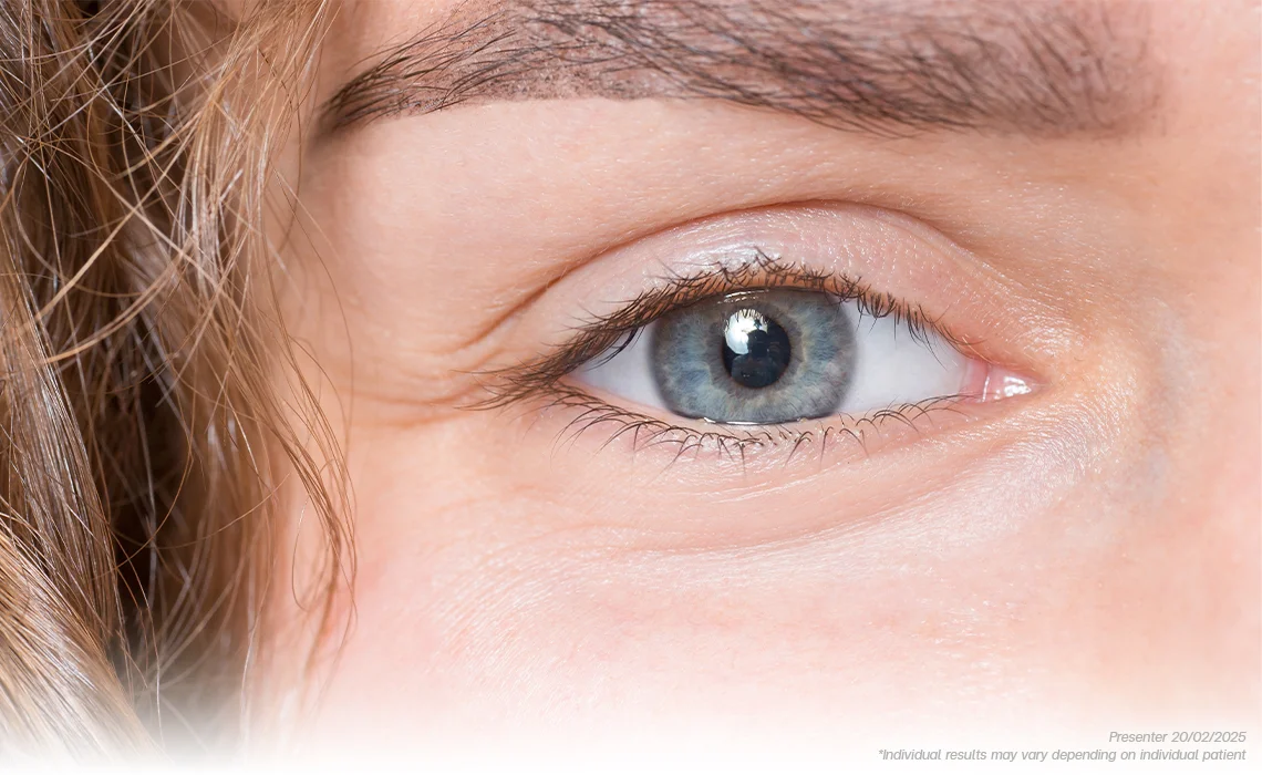 Periorbital eyes Wrinkles