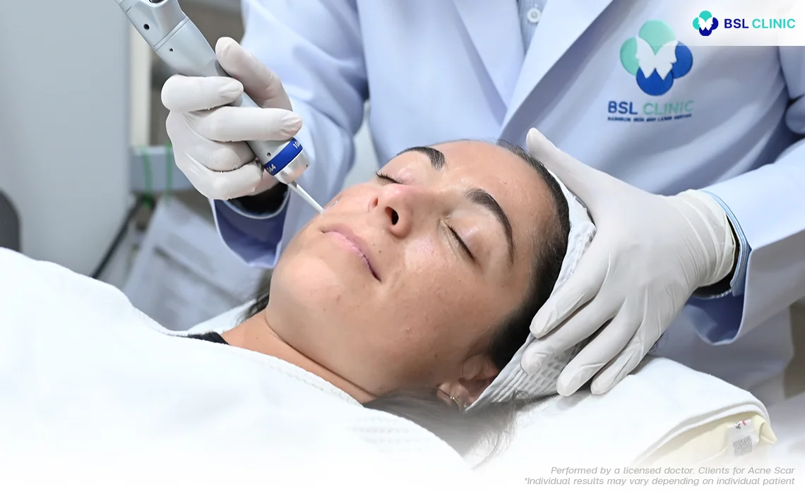 fraxel dual resurfacing laser treatment combined with picoway laser technology for skin renewal dual fraxel laser wavelength and fraxel laser used in advanced laser treatment at fraxel laser bangkok clinic