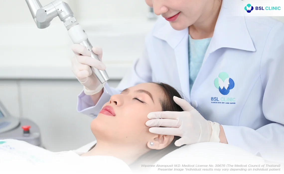 Pigmentation Removal Laser and Tattoo Removal