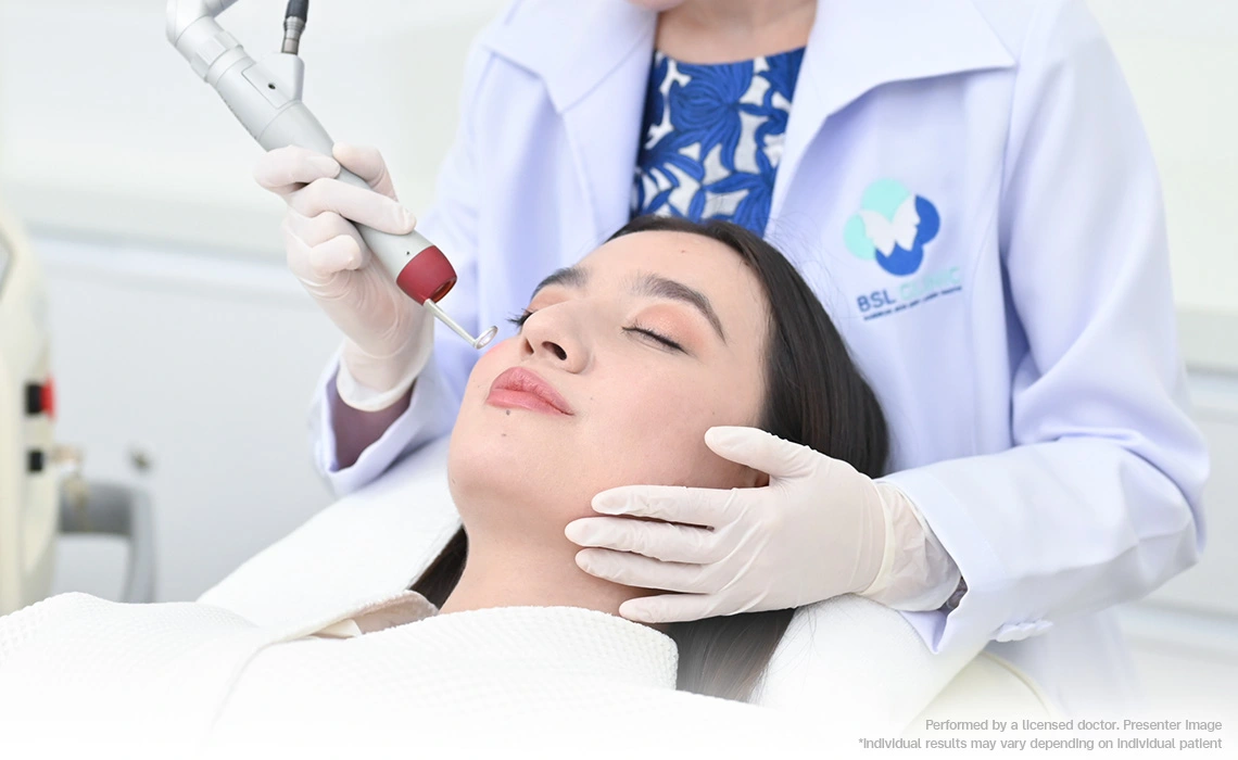 Preventions of Melasma