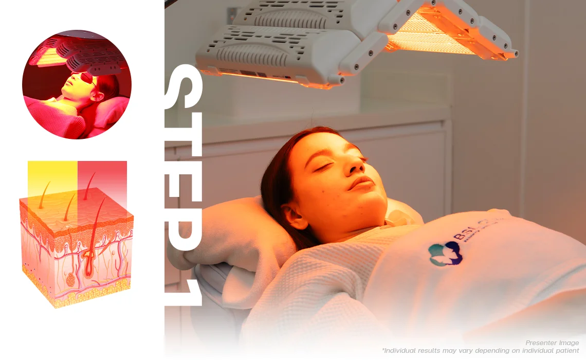 Reducing facial redness