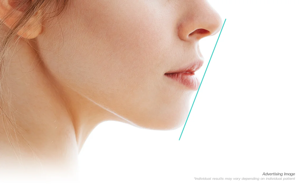 Side-View-Features-of-Ideal-Lips
