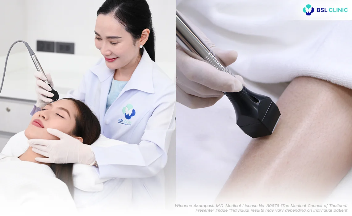 Skin Tightening Forma at bsl clinic