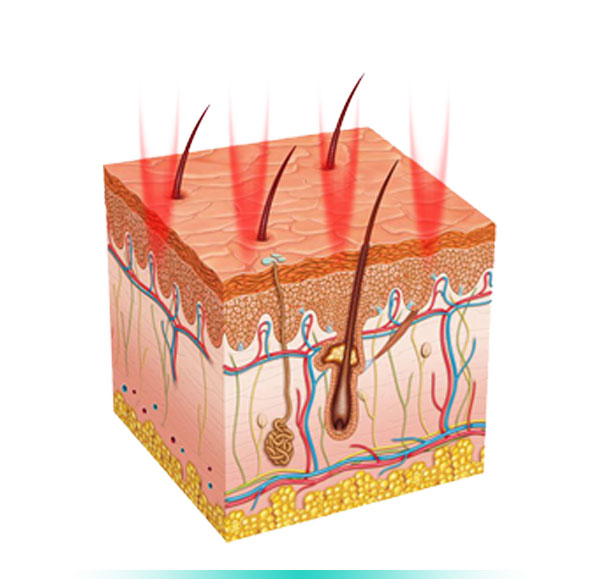 Steps in the Treatment of Sensitive Skin