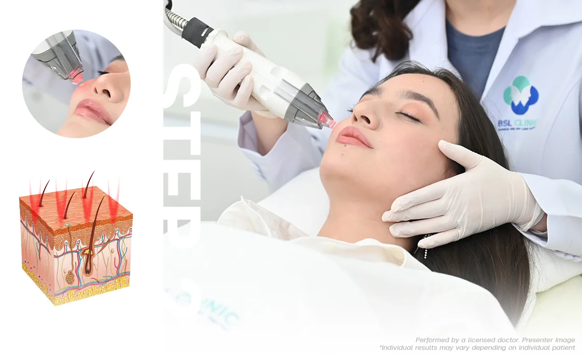 Stimulating the construction of new skin cells