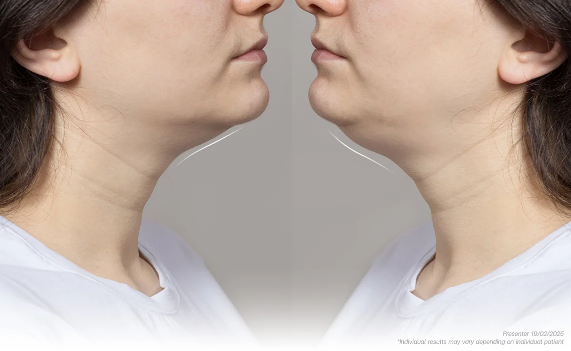 The-Causes-of-Neck-Wattle