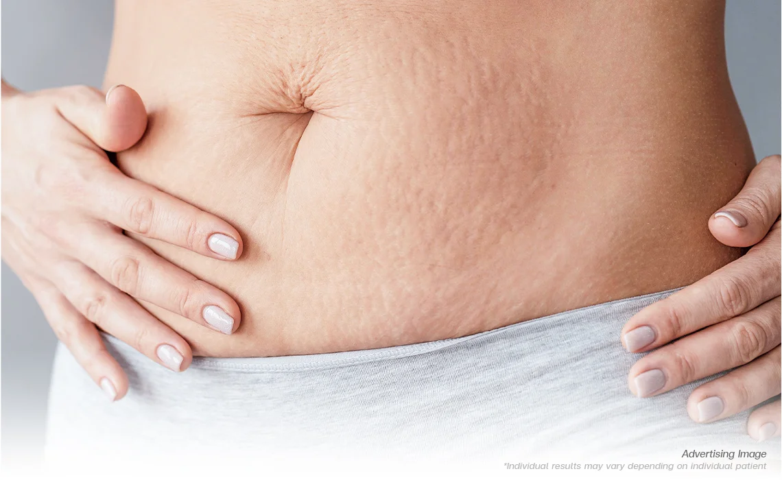 The Development of Saggy Skin
