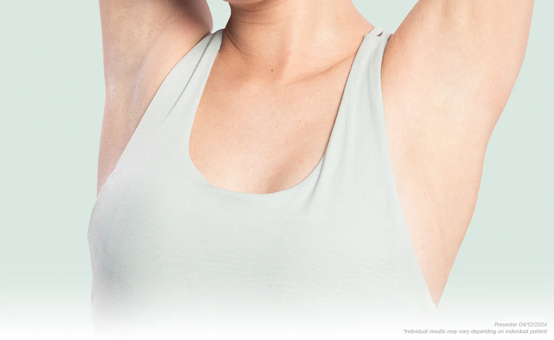 The results Hyperhidrosis treatment