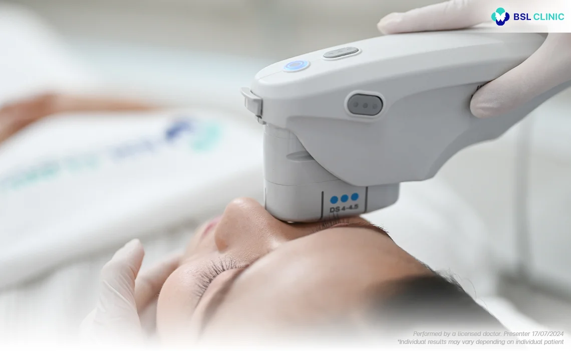 Ulthera treatment